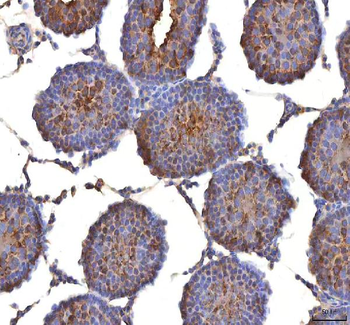 Anti-ISYNA1 Antibody