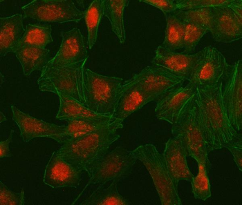 Anti-IRF5 Antibody