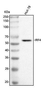 Anti-MUM1/IRF4 Antibody