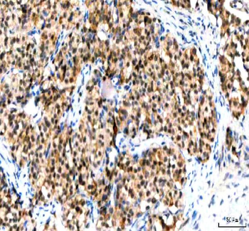 Anti-IPO9 Antibody