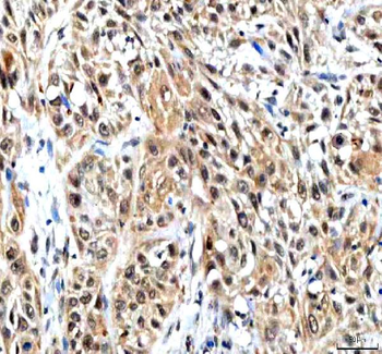 Anti-IPO9 Antibody