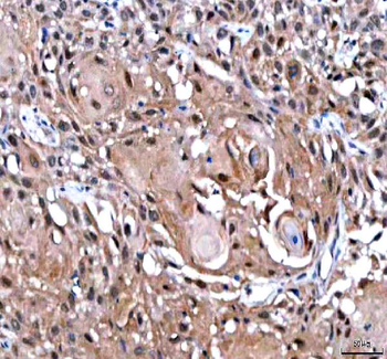 Anti-IPO9 Antibody