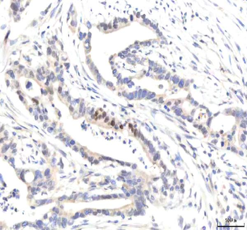 Anti-IPO8 Antibody
