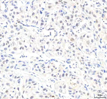 Anti-IPO8 Antibody