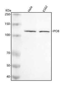 Anti-IPO8 Antibody
