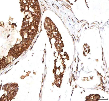 Anti-INTU Antibody