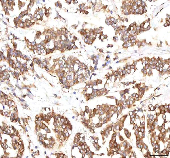 Anti-INTU Antibody