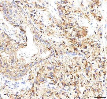 Anti-INTU Antibody