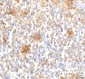 Anti-MFSD12 Antibody