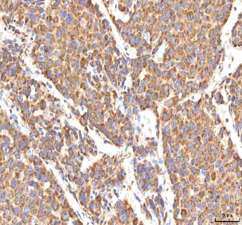 Anti-MANSC4 Antibody