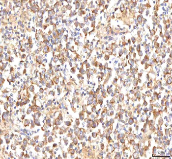 MANSC4 Rabbit Polyclonal Antibody