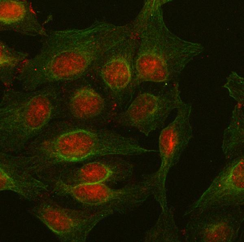 Anti-PKP2 Antibody