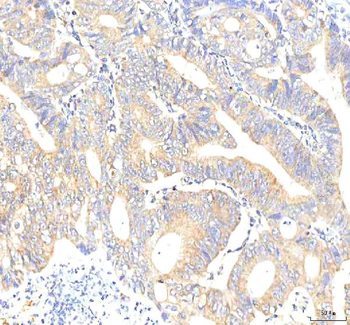 Anti-PKP2 Antibody