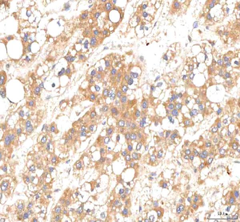 Anti-PKP2 Antibody