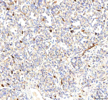 Anti-PKP2 Antibody
