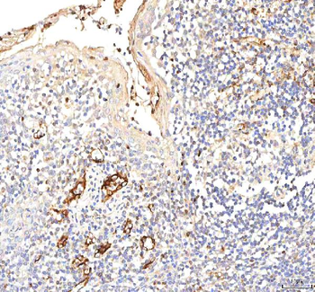 Anti-PKP2 Antibody
