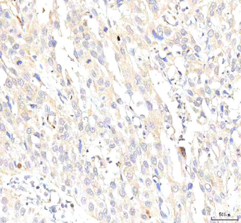 Anti-PKP2 Antibody