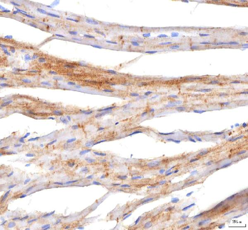 Anti-PKP2 Antibody