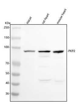 Anti-PKP2 Antibody