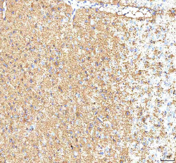 Anti-Hcn2 Antibody