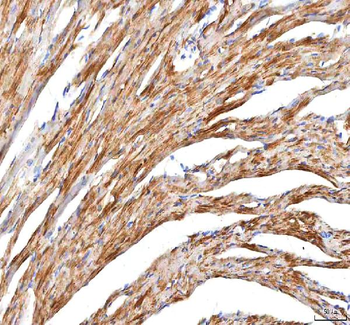 Anti-Hcn2 Antibody