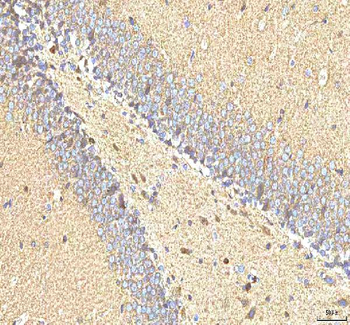 Anti-Hcn2 Antibody