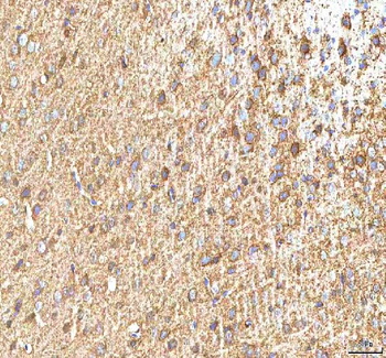 Anti-Hcn2 Antibody