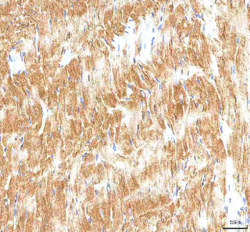 Anti-Hcn2 Antibody