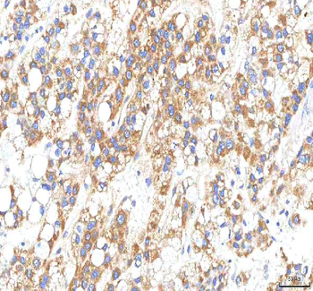 Anti-HTRA2 Antibody