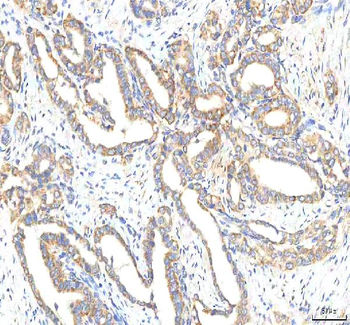 Anti-HTRA2 Antibody