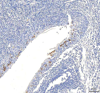 Anti-SGK493/PKDCC Antibody