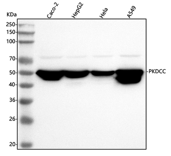 Anti-SGK493/PKDCC Antibody