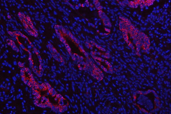 Anti-SGK493/PKDCC Antibody