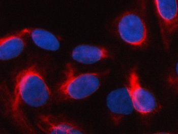 Anti-SGK493/PKDCC Antibody
