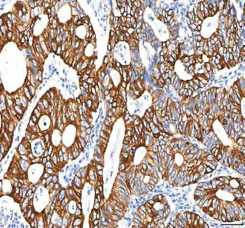 Anti-SGK493/PKDCC Antibody