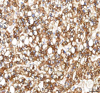 Anti-SGK493/PKDCC Antibody