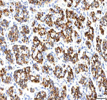 Anti-SGK493/PKDCC Antibody