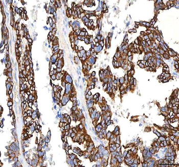 Anti-SGK493/PKDCC Antibody