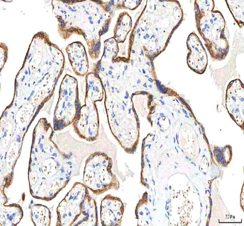 Anti-SGK493/PKDCC Antibody