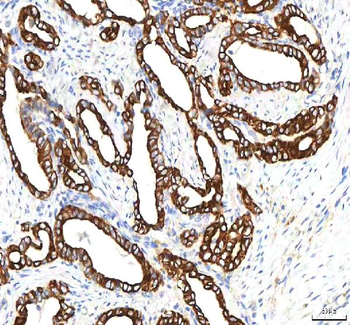 Anti-SGK493/PKDCC Antibody