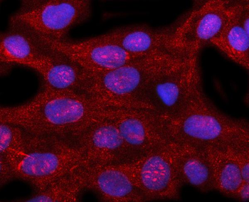 Anti-PIR Antibody