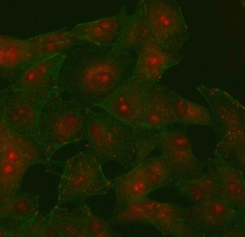 Anti-PI4K2B Antibody