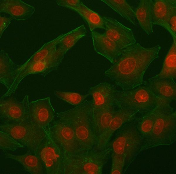Anti-PHF11 Antibody