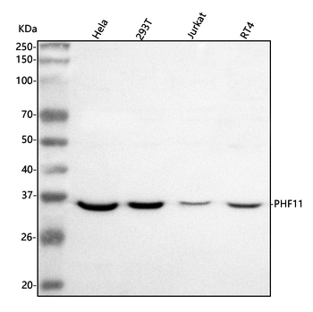 Anti-PHF11 Antibody