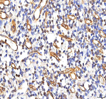 Anti-PHF6 Antibody