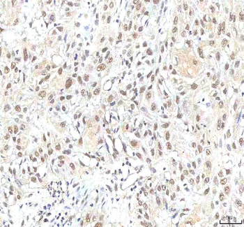 Anti-PHF6 Antibody