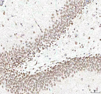 Anti-PHF6 Antibody