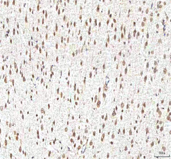 Anti-PHF6 Antibody
