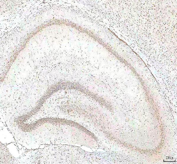 Anti-PHF6 Antibody
