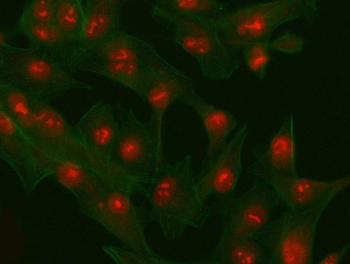 Anti-PHF6 Antibody